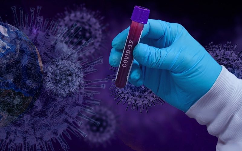 Enfermedades Tropicales, capacitado para realizar test diagnósticos PCR
