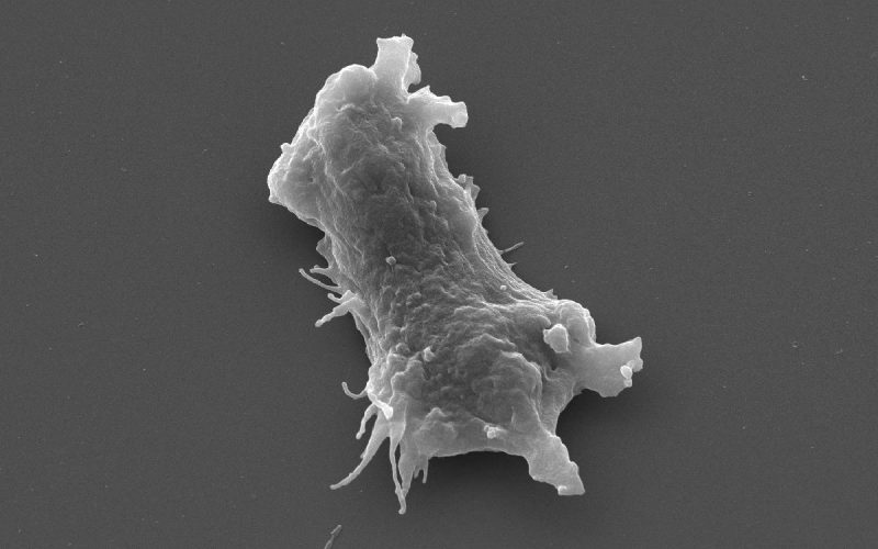 Naegleria_ameba-comecerebros