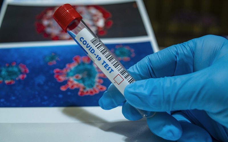 Enfermedades Tropicales refuerza su servicio de diagnóstico de la Covid-19