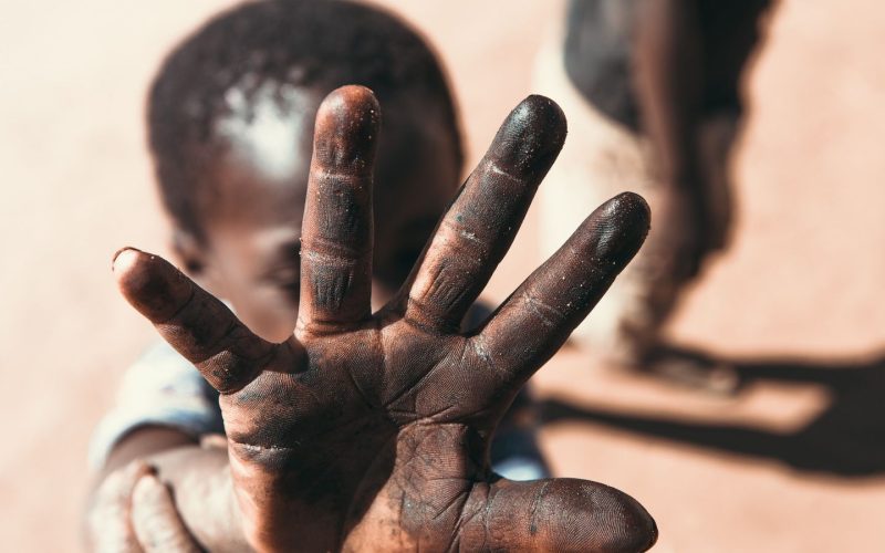 En Somalia, el 98% de las mujeres han sufrido mutilación genital. Foto: PULL